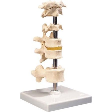 FABRICATION ENTERPRISES 3B® Anatomical Model - 6 Mounted Vertebrae with Removable Stand 983935